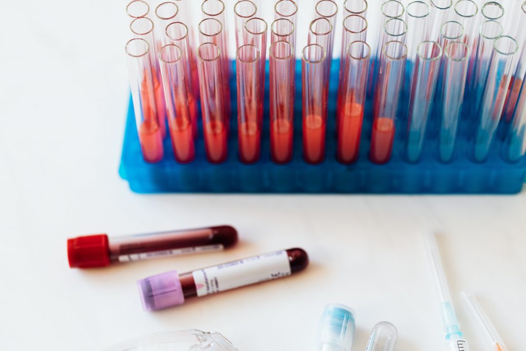 3 анализа крови, которые нужно сделать, чтобы узнать, долго ли вы будете жить