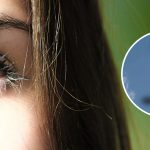 Видите мушки в глазках? У вас может быть болезнь или дефицит следующего витамина