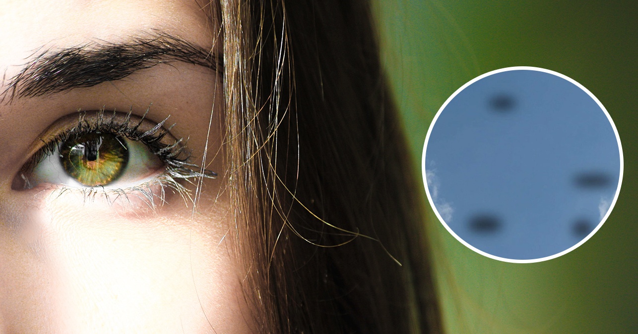 Видите мушки в глазках? У вас может быть болезнь или дефицит следующего витамина