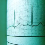 Когда следует беспокоиться о низком пульсе: симптомы, которые нельзя игнорировать