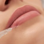 Що таке тентинг: переваги та недоліки контурної пластики губ