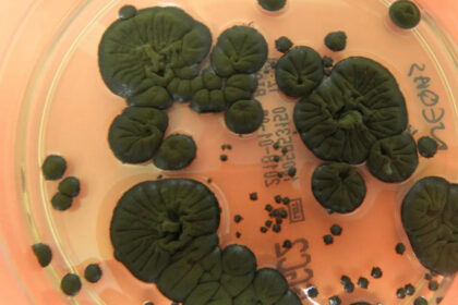 радіаційний грибок Cladosporium sphaerospermum.