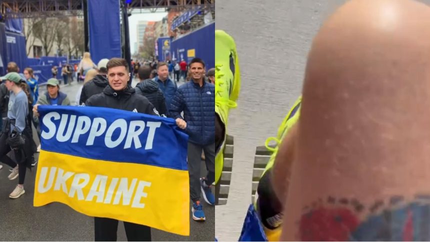 Анатолій Анатоліч опинився в кріслі колісному після Бостонського марафону: що сталося з ведучим