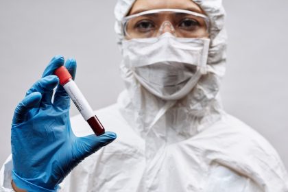 Новий субваріант COVID-19 «Цикада» в Україні: що таке, симптоми, лікування, профілактика