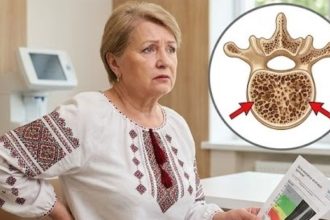 остеопороз, гормональна терапія, менопауза, втрата кісткової маси, здоров’я жінок, остеопенія, естроген